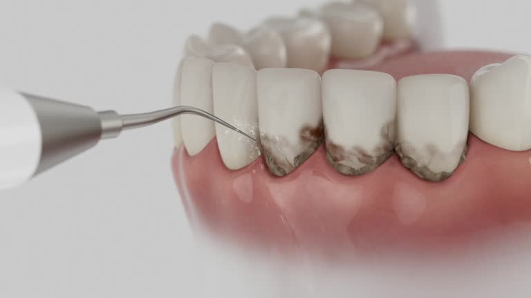 Reliable Tooth Extraction contractor in Midfield, AL by Smile Center Dentistry
